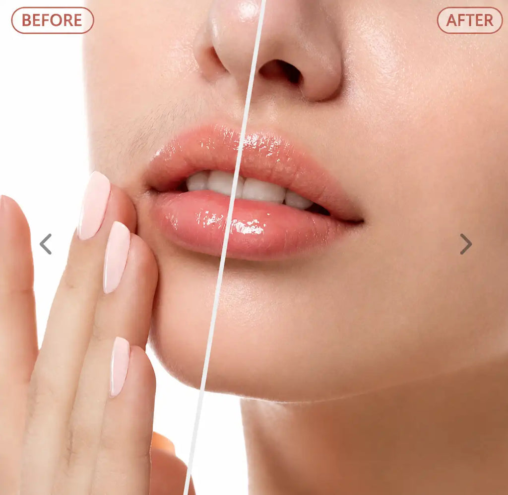 REMOVEDOR DE VELLO FACIAL PARA MUJER