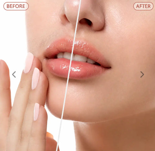 REMOVEDOR DE VELLO FACIAL PARA MUJER